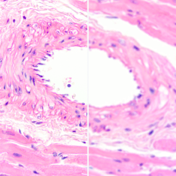 ピンボケした観察像のイメージ